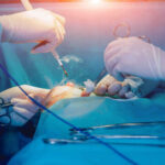 انواع جراحی های درمانی پستان